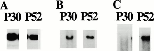 Fig. 7. Leukemic samples from patients P30 and P52 wereEcoRI digested, size fractionated on 1% agarose gel, and hybridized with the following probes: (A) control probe bcl-1; (B) probe p6E3.2, with densitometry results of 0.52 in patient sample P30 compared with the P52, which had no loss detected with any 13q14 probe, showing hemizygous loss for P30; and (C) probe P9.19, which recognizes a 19 EcoRI band present in cosmid C9a, with densitometry results of 0.02 for the P30 sample compared with the P52 sample, showing homozygous loss for P30.