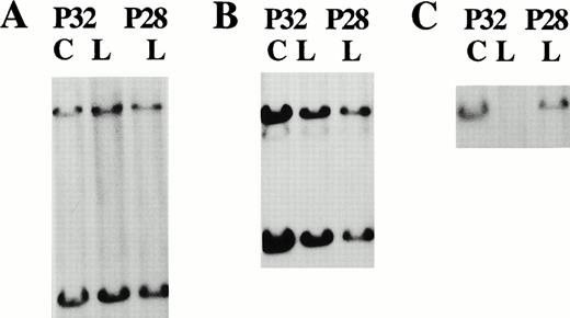 Fig. 8. Control (C) and leukemic (L) samples from patient P32, used to create the cell lines 183-Ccl and 183-E95, respectively, and leukemic sample from patient 28 were HindIII digested, fractionated on 1% agarose, and hybridized with the following probes: (A) control probe bcl-1; (B) p9E4.3, with densitometry results compared with control signals of 0.45 and 0.45, respectively, showing hemizygous loss and hemizygous loss, respectively; and (C) probe p6E.32, with densitometry results compared with control signals of 0.02 and 0.79 showing homozygous loss and biallelic retention, respectively.