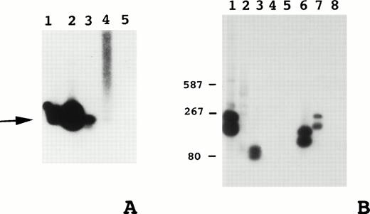 Fig. 1. (A) Southern blot of t(14;18) major breakpoint region PCR products to assess assay sensitivity. Dilutions of positive control (SU-DHL-6) DNA in negative control (HL60) DNA. 1, 1:103; 2, 1:104; 3, 1:105; 4, 1:106; 5, HL60 DNA; arrow, t(14;18) PCR product. (B) Example of Southern blot of t(14;18) major breakpoint region PCR products from patient biopsy specimens: 1, RL-7 positive control; 2, negative control; 3 to 8, patient PCR products. Size standards at left in base pairs.
