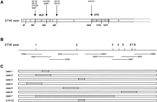 Fig. 1. Genomic breakpoints of the ETV6 gene. (A) Exon structure of the ETV6 mRNA showing the breakpoints of known translocations involving ETV6, (B) genomic structure of theETV6 gene showing the positions of the cosmid probes used for FISH, and (C) genomic regions of the ETV6 breakpoints as determined by FISH are indicated by the shaded areas.