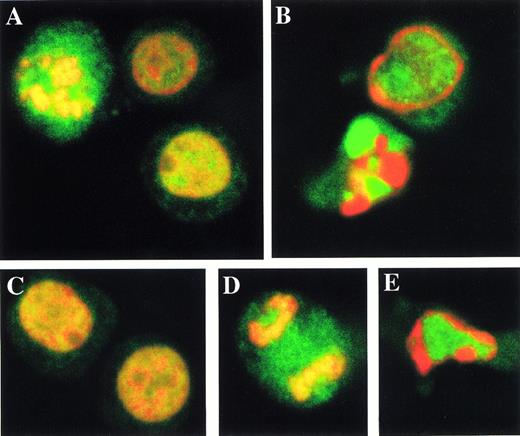 Fig. 7. Topo IIα and IIβ are dissociated from the chromatin during apoptosis. Logarithmically growing (A, C, and D) and apoptotic HL-60 cells treated with Ara-C for 5 hours (B and E) are immunostained with topo IIα-specific 8D2 (A and B) and topo IIβ-specific 3G3 monoclonal antibodies (C through E). Topo IIα and IIβ signals are green arising from the FITC-conjugated secondary antibody, and PI counterstaining for DNA is red.