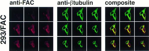 Fig. 6. Confocal laser-scanning of double-stained cells reveals that FAC protein colocalizes with a cytoplasmic protein marker (β tubulin). The arrangement of images is as described in Fig 5. In the optical sections shown, FAC protein is stained red, β tubulin is green, and colocalization is yellow. Although the cytoplasmic marker does not appear in the nuclei of the cells, FAC protein staining is evident.