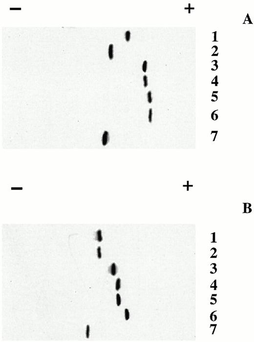 Fig. 1. Electrophoresis of purified β-globin chain variants β16 Gly→Asp, β95 Lys→Glu, β120 Lys→Glu, β16 Gly→Asp, 120 Lys→Glu and β112 Cys→Asp and in vitro assembled tetramers. Purified β-globin chain variants β16 Gly→Asp, β95 Lys→Glu, β120 Lys→Glu, β16 Gly→Asp, 120 Lys→Glu and β112 Cys→Asp (A) and in vitro assembled tetramers (B) formed by mixing with α-globin chains isolated from human red blood cells and incubating in 10 mmol/L potassium phosphate buffer pH 7.0 at 25°C were analyzed by electrophoresis on cellulose acetate membranes at pH 8.6 using Supre-Heme buffer (Helena Lab, Beaumont, TX). (A) Lane 1, βA chain (purified from human red blood cells); lane 2, β112 Cys→Asp chain; lane 3, β16 Gly→Asp chain; lane 4, β95 Lys→Glu chain; lane 5, β120 Lys→Glu chain; lane 6, β16 Gly→Asp, 120 Lys→Glu chain; and lane 7, βS chain (purified from human red blood cells). (B) Lane 1, Hb A (α2β2 purified from human red blood cells); lane 2, in vitro assembled α2β2 (β112 Cys→Asp); lane 3, in vitro assembled α2β2 (β16 Gly→Asp); lane 4, in vitro assembled α2β2 (β95 Lys→Glu); lane 5, in vitro assembled α2β2 (β120 Lys→Glu); lane 6, in vitro assembled α2β2 (β16 Gly→Asp, 120 Lys→Glu); and, lane 7, Hb S (α2β2S purified from human sickle red blood cells).