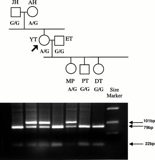 Fig. 1. Family tree for the Rhnull donor Y.T., showing inheritance of the RH50 allele containing the G836A mutation. PCR products were prepared from genomic DNA using primers D and C that span nt 820 to 908. Primer D has a 12-base tail added. The 101-bp PCR product obtained from each family member was digested withMnlI, and the fragments were analyzed on agarose gel. Products containing the G836 sequence are cut into 22- and 79-bp fragments, whereas those with A836 are uncut. The polymorphism at nt 836 (A or G) is indicated below each family member.