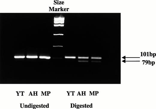 Fig. 2. Expression studies of the G836 or A836 alleles. cDNA was prepared from RNA extracts of blood samples and amplified by PCR using primers D and C. The 101-bp PCR products were digested withMnlI, and the fragments were analyzed on agarose gel. Products containing the G836 sequence are cut into 22- and 79-bp fragments, whereas those with A836 are uncut. After digestion, only the 101-bp fragment was detected with Y.T., indicating that only the allele carrying the A836 mutation is transcriptionally expressed. In contrast, both the 101- and 79-bp fragments were present in A.H. and M.P., indicating that both A836 and G836 are expressed.