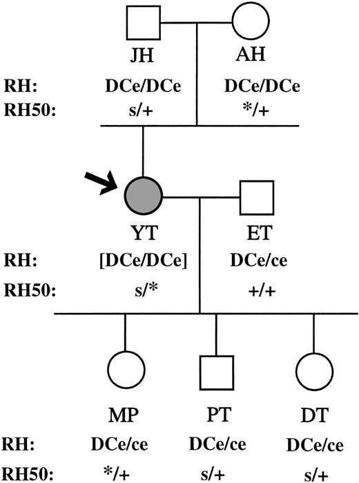 Fig. 3. RH and RH50 genotypes of family YT. RH50 alleles are as follows: +, wild-type carrying a G at nt 836; s, transcriptionally silent allele carrying a G at nt 836; *, mutant allele carrying an A at nt 836. The RH genotype of the Rhnull propositus Y.T. is shown in brackets since it is not phenotypically expressed.