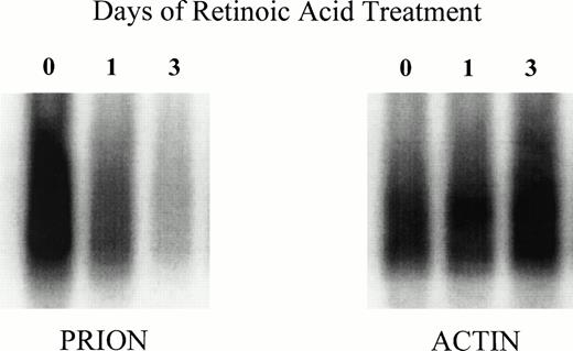 Fig. 6. Downregulation of PrP mRNA in retinoic acid–induced differentiation of HL-60 cells. HL-60 cells were cultured in the presence of 1 mol/L all-trans retinoic and obtained at days 0, 1, and 3. Total RNA was isolated and reverse-transcribed to cDNA, which was then used for both prion and β-actin amplification by PCR. The PCR products were then Southern blotted with radioactively labeled PrP and β-actin probes. Blots were analyzed by PhosphorImager scanning.