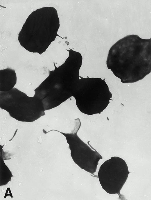Fig. 4. (A) Representative resting WF rat platelets prepared identically to resting Wistar platelets in Fig 2. (B through E) WF rat platelets allowed to adhere to Formvar-coated, carbon-stabilized grids from 30 seconds to 30 minutes, and subsequently fixed and stained with uranyl acetate. (B through E) illustrate the forms characteristic of WF rat platelet spreading, including platelets with stubby filopodia (B), lamellipodia (C), or fully spread forms (D and E). (E) shows the spread margin of a WF platelet at higher power. The arrowheads indicate microtubules and the asterisk shows the dense peripheral weave at the platelet margin. (B) 30-second adherent sample, (C) 1-minute adherent sample, (D and E) 30-minute adherent sample. (A through D, original magnification ×7,000; E, original magnification ×19,000).