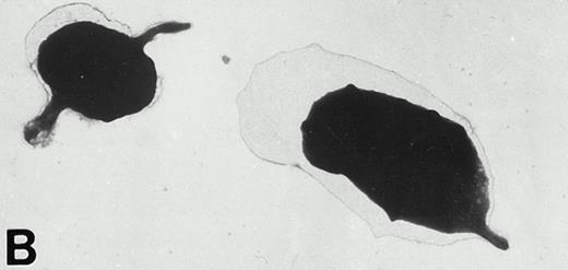 Fig. 4. (A) Representative resting WF rat platelets prepared identically to resting Wistar platelets in Fig 2. (B through E) WF rat platelets allowed to adhere to Formvar-coated, carbon-stabilized grids from 30 seconds to 30 minutes, and subsequently fixed and stained with uranyl acetate. (B through E) illustrate the forms characteristic of WF rat platelet spreading, including platelets with stubby filopodia (B), lamellipodia (C), or fully spread forms (D and E). (E) shows the spread margin of a WF platelet at higher power. The arrowheads indicate microtubules and the asterisk shows the dense peripheral weave at the platelet margin. (B) 30-second adherent sample, (C) 1-minute adherent sample, (D and E) 30-minute adherent sample. (A through D, original magnification ×7,000; E, original magnification ×19,000).