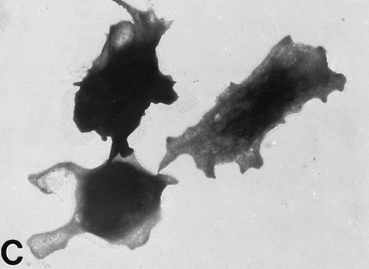 Fig. 4. (A) Representative resting WF rat platelets prepared identically to resting Wistar platelets in Fig 2. (B through E) WF rat platelets allowed to adhere to Formvar-coated, carbon-stabilized grids from 30 seconds to 30 minutes, and subsequently fixed and stained with uranyl acetate. (B through E) illustrate the forms characteristic of WF rat platelet spreading, including platelets with stubby filopodia (B), lamellipodia (C), or fully spread forms (D and E). (E) shows the spread margin of a WF platelet at higher power. The arrowheads indicate microtubules and the asterisk shows the dense peripheral weave at the platelet margin. (B) 30-second adherent sample, (C) 1-minute adherent sample, (D and E) 30-minute adherent sample. (A through D, original magnification ×7,000; E, original magnification ×19,000).