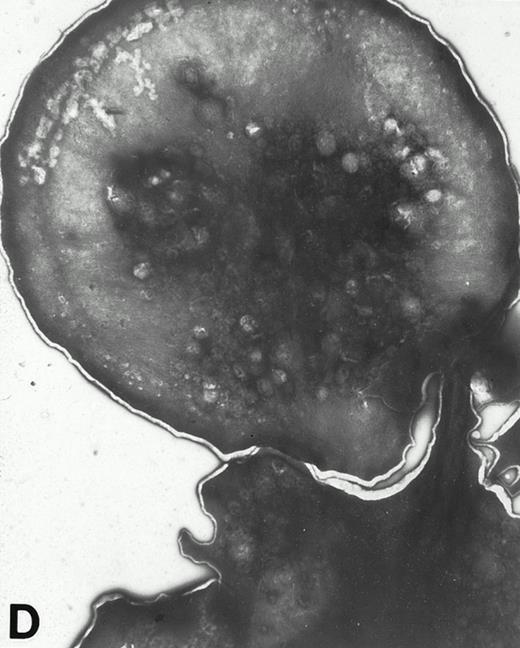 Fig. 4. (A) Representative resting WF rat platelets prepared identically to resting Wistar platelets in Fig 2. (B through E) WF rat platelets allowed to adhere to Formvar-coated, carbon-stabilized grids from 30 seconds to 30 minutes, and subsequently fixed and stained with uranyl acetate. (B through E) illustrate the forms characteristic of WF rat platelet spreading, including platelets with stubby filopodia (B), lamellipodia (C), or fully spread forms (D and E). (E) shows the spread margin of a WF platelet at higher power. The arrowheads indicate microtubules and the asterisk shows the dense peripheral weave at the platelet margin. (B) 30-second adherent sample, (C) 1-minute adherent sample, (D and E) 30-minute adherent sample. (A through D, original magnification ×7,000; E, original magnification ×19,000).