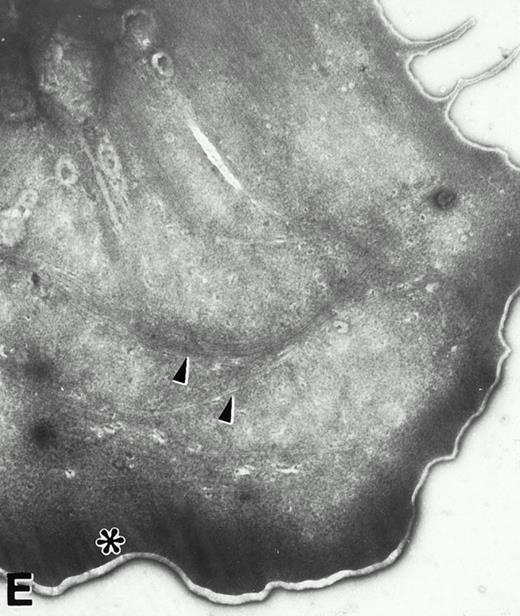 Fig. 4. (A) Representative resting WF rat platelets prepared identically to resting Wistar platelets in Fig 2. (B through E) WF rat platelets allowed to adhere to Formvar-coated, carbon-stabilized grids from 30 seconds to 30 minutes, and subsequently fixed and stained with uranyl acetate. (B through E) illustrate the forms characteristic of WF rat platelet spreading, including platelets with stubby filopodia (B), lamellipodia (C), or fully spread forms (D and E). (E) shows the spread margin of a WF platelet at higher power. The arrowheads indicate microtubules and the asterisk shows the dense peripheral weave at the platelet margin. (B) 30-second adherent sample, (C) 1-minute adherent sample, (D and E) 30-minute adherent sample. (A through D, original magnification ×7,000; E, original magnification ×19,000).