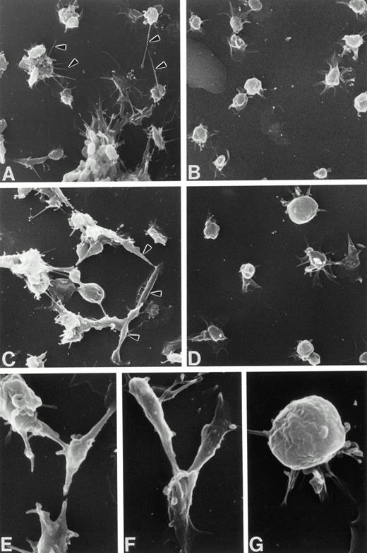 Fig. 7. Scanning electron micrographs of adherent Wistar (A, C, E, and F) and WF (B, D, and G) rat platelets from 1 to 2 minutes postadherence on poly-L-lysine–coated coverslips. Wistar platelets extend fine filopodia from round or spreading bodies (A, arrowheads) or exhibit spindle-shaped forms (C, arrowheads; higher magnification, E and F), unlike WF platelets, the majority of which are rounded, spreading with lamellipodial skirts, or fully spread. (A through D, original magnification ×2,800; E through G, original magnification ×7,100).