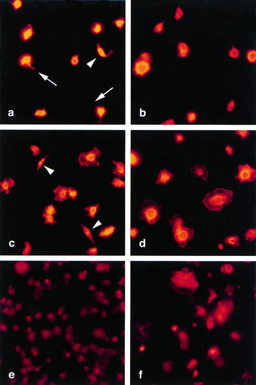 Fig. 6. Absence of spindle-shaped forms among adhered WF rat platelets. Immunofluorescence staining of Wistar (a, c, and e) and WF (b, d, and f) rat platelets with rhodamine-phalloidin after 30 seconds (a and b), 1 minute (c and d), or 30 minutes (e and f) of adherence to poly-L-lysine coated glass coverslips. Spindle-shaped Wistar platelet forms are indicated by arrows (a and c); these forms are absent in WF rat platelet preparations (b and d), which contain rounded or spreading forms. By 30 minutes, the majority of Wistar and WF rat platelets are fully spread. Original magnification ×630.