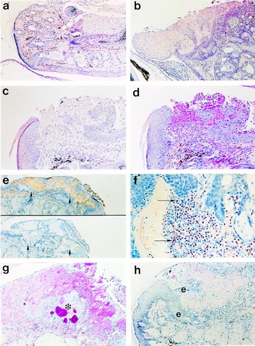 Fig. 4. Photomicrographs of (a) normal palpebral conjunctiva from a Plg+/− mouse in contrast with (b through h) Plg−/− mice. (b) Large eosinophilic deposits with low cellular density constitute the majority of the area occupied by lesions. (c) Disrupted epithelium was associated with (d) amorphous PAS+ material (in the same lesion). (e) The amorphous material stained with an anti-mouse Fib antiserum (top) but not with normal rabbit serum (bottom; arrowheads indicate lesion area). (f) An acute inflammatory infiltrate with prominent neutrophils (arrows) is adjacent to amorphous, eosinophilic material. (g) Epithelial cells, including PAS+ goblet cells, existing as a discreet cluster (*) inside the eyelid show the degree of disorganization of the epithelium. (h) Reduplication of the epithelium (denoted by “e”) occurred adjacent to eosinophilic deposits. Panels b, c, and h are hematoxylin and eosin preparations; panels a, d, and g are PAS preparations; panel f is a Leder stain. Original magnifications are 100× (panels b and e), 200× (panels a, c, d, g, and h) and 400× (panel f).