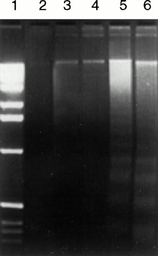 Fig. 3. DNA degradation in Ramos cells caused by anti-CD20 MoAb (B1) plus GAM shown by agarose gel electrophoresis. Ramos cells (2 × 106) were treated with 10 μg/mL control anti-CD3 MoAb (64.1) or anti-CD20 MoAb (B1) in the presence or the absence of GAM cross-linker (50 μg/mL) at 37°C for 24 hours. Fragmented DNA was isolated and analyzed on a 2% agarose gel. Lane 1, molecular weight markers; lane 2, 64.1; lane 3, 64.1 + GAM; lane 4, B1; lane 5, B1 + GAM; lane 6, anti-sIgM.