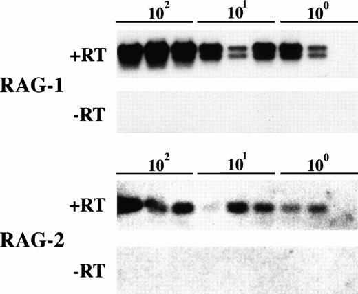 Fig. 3. Sensitivity of RAG-1 and RAG-2 PCR assays. RAG-1 and RAG-2 expressing Jurkat cells were serially diluted with phosphate-buffered saline. mRNA was extracted and PCR performed as described in Materials and Methods. The data shown is an autoradiograph after hybridization with RAG-1 and RAG-2 sequence specific probes. Transcripts for both recombinase activating genes (+RT) were detected in two of three replicates from the same sample at the single cell level. The absence of genomic recombinase activating gene sequences was confirmed by amplification of mRNA without prior reverse transcription for the 100-, 10-, and 1-cell dilutions (−RT).