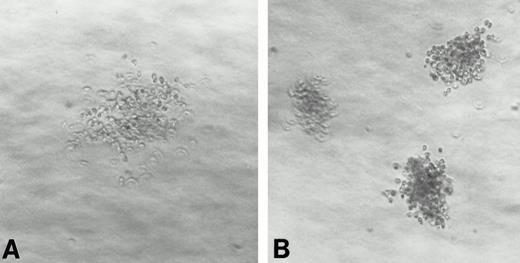 Fig. 1. BCP-1 (A) and HBL-6 (B) cells grow in soft agar and form loose disaggregated colonies.