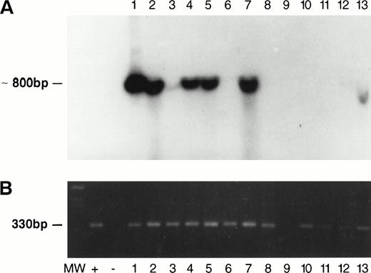 Fig. 5. Southern blot (A) and PCR (B) for KSHV in various mouse tissues. (Note Southern blots were done independently of PCR and do not represent blotting of PCR products.) MW, molecular markers. Lane 1: Southern blot and PCR-positive ascitic cells from HBL-6 ip-injected mouse. Lane 2: Southern blot and PCR-positive tumor cells from HBL-6 iv-injected mouse. Lane 3: PCR-positive small intestine from HBL-6 iv-injected mouse. Lane 4: Southern blot and PCR-positive testis from HBL-6 iv-injected mouse. Lane 5: Southern blot and PCR-positive kidney from HBL-6 iv-injected mouse. Lane 6: PCR-positive heart from HBL-6 iv-injected mouse. Lane 7: Southern blot and PCR-positive lungs from HBL-6 iv-injected mouse. Lane 8: PCR-positive spleen from HBL-6 iv-injected mouse. Lane 9: Blank. Lane 10: PCR-positive kidney from BCP-1 iv-injected mouse. Lane 11: PCR-positive (weakly) lung from BCP-1 iv-injected mouse. Lane 12: PCR-positive (weakly) liver from BCP-1 iv-injected mouse. Lane 13: PCR-positive thymus from BCP-1 iv-injected mouse.