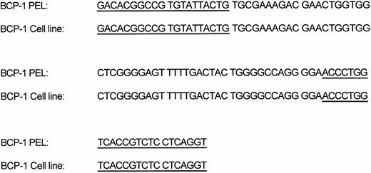 Fig. 8. PCR products of Ig heavy chain gene rearrangement analysis.