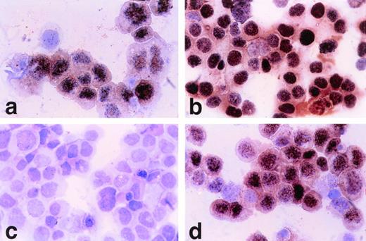 Fig. 7. (a) Polyclonal anti–EBNA1-6 human antisera (CP). Nuclear positive staining on HBL-6 (KSHV+, EBV+) cells. (630× magnification). (b) Polyclonal anti–EBNA1-6 (CP) shows all EBV+ B958 cells have nuclear reactivity. (c) Monoclonal anti–EBNA-2 shows no staining of HBL-6 cells, but B958 cells are positive (d).