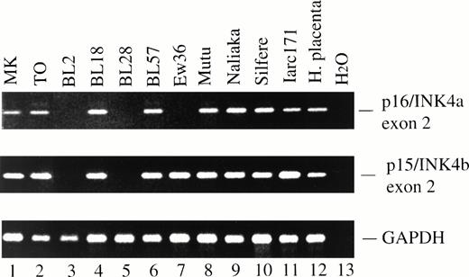 Fig. 2. PCR amplification of exon 2 of p16/INK4a (top) and p15/INK4b (middle). BL2 (lane 3) and BL28 (lane 5) had homozygous deletion of exon 2 of both p16/INK4a and p15/INK4b, whereas Ew36 (lane 7) had homozygous deletion of p16/INK4a exon 2 but retained p15/INK4b exon 2. The expected p16/INK4a and p15/INK4b PCR products were obtained from genomic DNA from all primary BL biopsies indicated in Table 1. Two examples, MK and TO, are shown (lanes 1 and 2). Lanes 3 to 10, BL lines; lane 11, LCL. DNA integrity was confirmed using primers specific for GAPDH exon 8 (bottom).