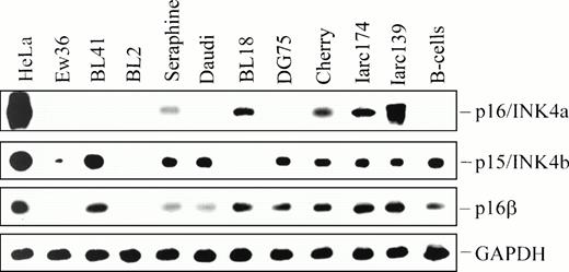 Fig. 3. Detection of p16/INK4a, p16β/INK4a, and p15/INK4b mRNA by RT-PCR and hybridization with an internal probe. After electrophoresis, PCR products were transferred to nylon filters and hybridized with probes corresponding to exon 1 of p16/INK4a, p16β/INK4a, p15/INK4b, and rat GAPDH cDNA. Hybridizing bands were visualized by Phospholmager.