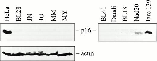 Fig. 4. Western blot analysis of p16 expression in BL biopsies (left panel), cell lines, and LCLs (right panel). HeLa cells were used as positive control. An actin antibody was used as an internal control to confirm protein integrity.
