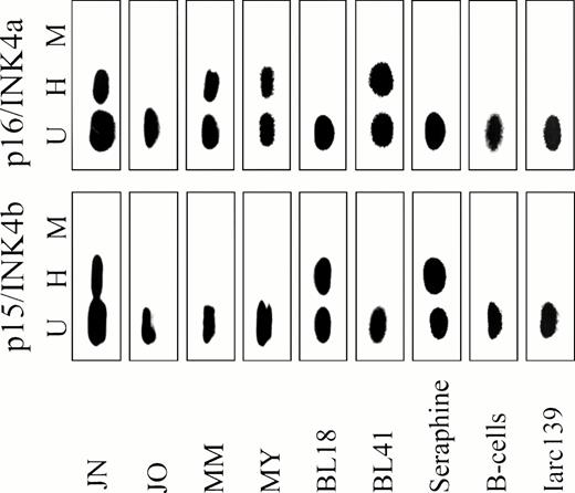 Fig. 5. Methylation of exon 1 of p15/INK4b (bottom panel) and p16/INK4a (top panel) in representative BL biopsies, BL lines, LCLs, and normal B cells. Genomic DNA was digested with HpaII (H),Msp I (M), or left undigested (U), and analyzed by PCR followed by hybridization with an internal probe, as shown in Fig 1.