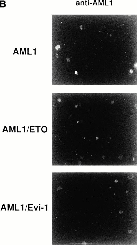 Fig. 3. (A) (see page 1690) Subcellular localization of full-length or mutant AML1/ETO(MTG8) and AML1/Evi-1. A total of 3 × 104 COS-7 cells were transfected with 4 μg of each construct as indicated and analyzed by immunofluorescence labeling with anti-AML1 serum. Original magnification × 600. (B) The staining pattern of the cells overexpressing AML1 (upper panel), AML1/ETO(MTG8) (middle panel), or AML1/Evi-1 (lower panel) in lower magnification (× 100). (C) Identification of full-length or mutant AML1/ETO(MTG8) and AML1/Evi-1 in cytoplasmic (lanes C) and nuclear (lanes N) fractions of COS-7 cells. COS-7 cells were transfected with the same amount of each construct as indicated in (A), lysed, fractionated, and subjected to SDS-PAGE and immunoblotting using anti-AML1 serum. Each protein was expressed at the anticipated size, as marked by the arrowhead. The cell lysate of untransfected COS-7 cells was also analyzed as a control (mock). Western blotting of the actin and Rb proteins are shown as known cytoplasmic and nuclear proteins, respectively. Molecular weight standards (in kilodaltons) are indicated.