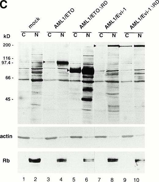 Fig. 3. (A) (see page 1690) Subcellular localization of full-length or mutant AML1/ETO(MTG8) and AML1/Evi-1. A total of 3 × 104 COS-7 cells were transfected with 4 μg of each construct as indicated and analyzed by immunofluorescence labeling with anti-AML1 serum. Original magnification × 600. (B) The staining pattern of the cells overexpressing AML1 (upper panel), AML1/ETO(MTG8) (middle panel), or AML1/Evi-1 (lower panel) in lower magnification (× 100). (C) Identification of full-length or mutant AML1/ETO(MTG8) and AML1/Evi-1 in cytoplasmic (lanes C) and nuclear (lanes N) fractions of COS-7 cells. COS-7 cells were transfected with the same amount of each construct as indicated in (A), lysed, fractionated, and subjected to SDS-PAGE and immunoblotting using anti-AML1 serum. Each protein was expressed at the anticipated size, as marked by the arrowhead. The cell lysate of untransfected COS-7 cells was also analyzed as a control (mock). Western blotting of the actin and Rb proteins are shown as known cytoplasmic and nuclear proteins, respectively. Molecular weight standards (in kilodaltons) are indicated.