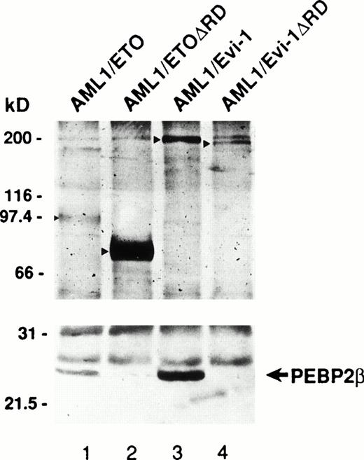Fig. 5. Association of AML1/ETO(MTG8) and AML1/Evi-1 with PEBP2β. COS-7 cells (1 × 106) were transfected with 10 μg of the expression plasmids for full-length or mutant chimeric protein together with 1 μg of that for PEBP2β. Cells were lysed, immunoprecipitated with anti-AML1 serum, and subjected to Western blotting with anti-AML1 serum or rabbit anti-PEBP2β serum. Arrowheads show the positions of full-size and mutant chimeric proteins. The position of PEBP2β is marked by the arrow. Molecular weight standards (in kilodaltons) are indicated.