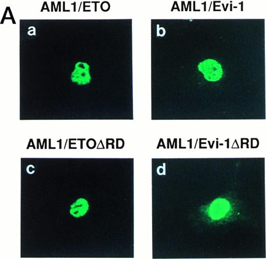 Fig. 4. Double fluorescence labeling of COS-7 cells transfected with the constructs of full-length or mutant chimeric proteins and PEBP2β. A total of 3 × 104 COS-7 cells were transfected with 4 μg of each construct together with 0.4 μg of the expression plasmid for PEBP2β. (a, b, c, and d) The chimeric proteins were detected with anti-AML1 serum. (e, f, g, and h) PEBP2β was detected with hamster anti-PEBP2β serum. Original magnification × 600.