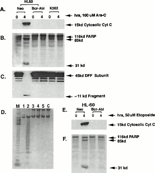 Fig. 1. Western analysis of cytosolic levels of cyt c (A); 116-kD35S-labeled, in vitro–translated PARP or its cleaved products (B); 45-kD DFF subunit or its 11-kD cleavage fragment (C); as well as the internucleosomal DNA fragmentation in the untreated and HIDAC-treated HL-60/neo (D, lanes 1 and 2), HL-60/Bcr-Abl (lanes 3 and 4), or K562 cells (lanes 5 and 6). Lane M in (D) represents the 123-bp marker DNA ladder. (E and F) Show Western analyses of the levels of cytosolic cyt c (E) and PARP or its cleaved products (F) in the untreated or etoposide-treated HL-60/neo or HL-60/Bcr-Abl cells.