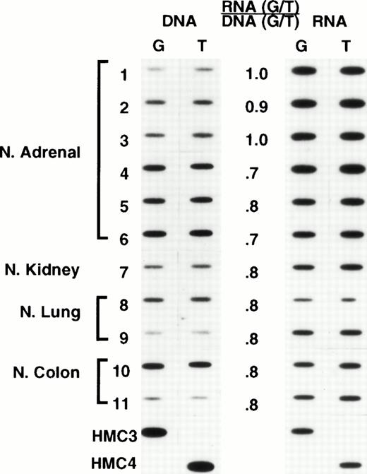 Fig. 3. Normal tissues: Oligonucleotide hybridization of PCR-amplified DNA and RNA is shown on the left and right of the figure, respectively. The results were quantified by dividing the ratio of RNA expression by the ratio of genomic copies in DNA. A ratio of 1 indicates that both alleles are expressed at comparable levels. HMC-3 and HMC-4 are control oligonucleotides having a G and a T at position 2677. Samples 1 through 6, normal adrenal gland; 7, normal kidney; 8 and 9, normal lung; 10 and 11, normal colon.