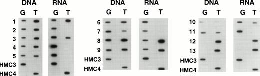 Fig. 5. Expression of individual alleles in tumor samples obtained from patients with refractory lymphoma.