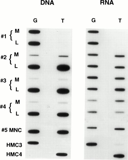 Fig. 6. Expression of individual alleles in circulating mononuclear cells obtained from patients with refractory lymphoma.