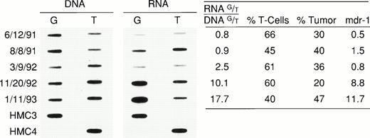 Fig. 7. Expression of individual alleles in a patient with refractory lymphoma over time. The MDR-1 level determined by quantitative PCR as well the percent of normal and malignant cells in the biopsies are tabulated. Over time, the patient was treated with multiple regimens, all of which contained “MDR-1 drugs.”