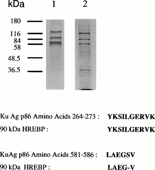Fig. 2. Analyses of protein bound to HRE-derivatized magnetic beads. (A) SDS-PAGE analysis. Nuclear extracts from hemin-treated U937 cells were incubated with magnetic beads derivatized with the 27-mer HRE DNA sequence as described in Materials and Methods. Bound proteins were released by boiling in Laemmli buffer, then separated by SDS-PAGE in 10% acrylamide gels. Protein bonds were visualized by silver or Coomassie blue staining. Lanes 1 and 2 depict results of two separate isolations. (B) Microsequence analysis of two peptides from the 90-kD HREBP band. Digests were sequenced on an Applied Biosystems 477A sequencer with an ABI 120 HPLC. KuAg p86 sequences are from the BLAST data base. Swiss-Prot accession:P13010; NCBI Seq ID:125731. (C) Immunoblot analyses of isolates in (A) with anti-KuAg monoclonal antibodies. Lane 1, Ab-3, clone 162 recognizing p70/p80; lane 2, Ab-4, clone N3H10 recognizing p70; lane 3, Ab-2, clone 11D recognizing p80.