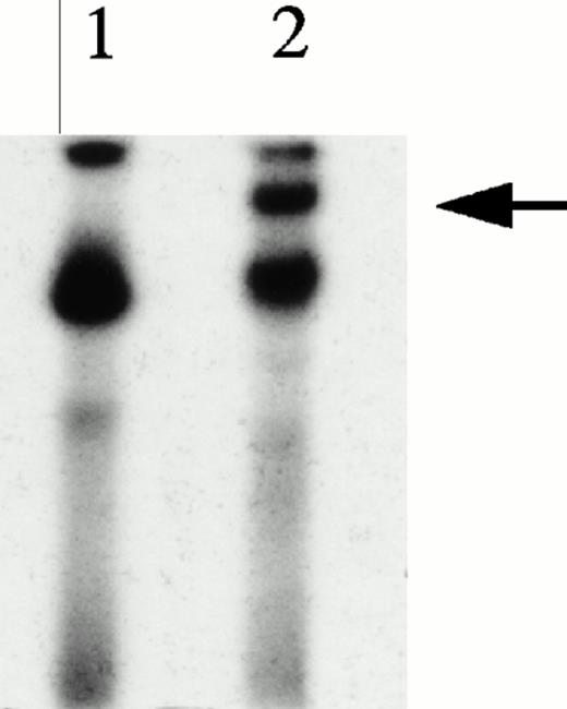Fig. 3. KuAg is bound to HREs in gel mobility assays with nuclear extracts from hemin-treated U937 cells. (A) Supershift experiment. Gel mobility assays with radiolabeled 27-bp HRE probes were performed as described in Materials and Methods. Supershift experiments included an additional 30-minute incubation with Ab-3. Lane 1, standard gel mobility assay; lane 2, parallel supershift experiment with Ab-3. The arrow indicates the supershifted band. (B) Shift-Western experiments. Gel mobility assays with HRE probes were performed, followed by electrophoretic transfer of proteins and probes to stacked nitrocellulose and PVDF membranes as described in Materials and Methods. Panel 1, autoradiography of PVDF membrane. Remaining panels are immunoblots of nitrocellulose membrane with the anti-KuAg monoclonals Ab-4 (anti-P70), panel 2; and Ab-2 (anti-p80), panel 3; or with the anti-ref1 antibody, panel 4. Each panel depicts duplicate lanes. The arrow indicates the location of the shift band. The band at the top of each lane corresponds to the position of the sample wells. (C) Gel mobility assays with Ku depleted extracts. Nuclear extracts were prepared from hemin-treated U937 cells, then depleted of KuAg by serial incubations with Ab-3–derivatized magnetic beads as described in Materials and Methods. Panel I depicts standard gel mobility assays with radiolabeled 27-bp HRE probe. Lane 1, free probe; lane 2, undepleted extract; lanes 3 to 6 extract after 1, 2, 3, or 4 incubations, respectively, with anti-KuAg beads. Panel II: immunoblot of KuAg depleted extracts using antibody Ab-3. Lanes correspond to those of panel I. The arrow indicates the position of the largest gel shift band.