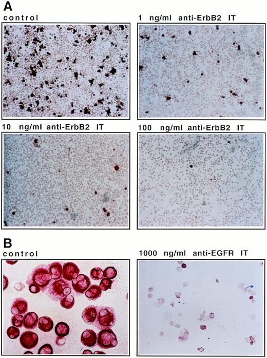 Fig. 5. Elimination of mammary carcinoma cells during ex vivo culture in the presence of IT. (A) The 7-day time point of a 1:10 mixture of MDA-MB-453 breast cancer cells and CD34+progenitor cells as shown in Fig 4A was immunostained with anticytokeratin antibodies and photographed at 100× magnification. Anti–Erb-B2 IT was present in the cultures at the indicated concentrations. (B) Tumor cells from patient no. 5 (Table 2) were cultured in α-MEM/10% FCS without (control) and with 1,000 ng/mL anti–EGF receptor (EGFR) IT for 7 days. Cells were fixed on glass slides, stained with anticytokeratin antibodies, and photographed at identical (1,000×) magnification.