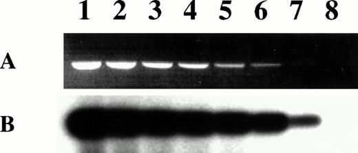 Fig. 4. Sensitivity of KSHV PCR. Lanes 1 through 8 contain 10-fold dilutions of BCBL-1 DNA from 1 μg (lane 1) to 0.1 pg (lane 8). BCBL-1 DNA was diluted in the KSHV-negative XG-1 MM cell line DNA so that all the PCR were run on 1 μg of total DNA. (A) Ethidium bromide-stained agarose gel of the 233-bp amplification products. (B) Specific hybridization of the PCR products to a32P-end-labeled internal probe after transfer to a nylon membrane.
