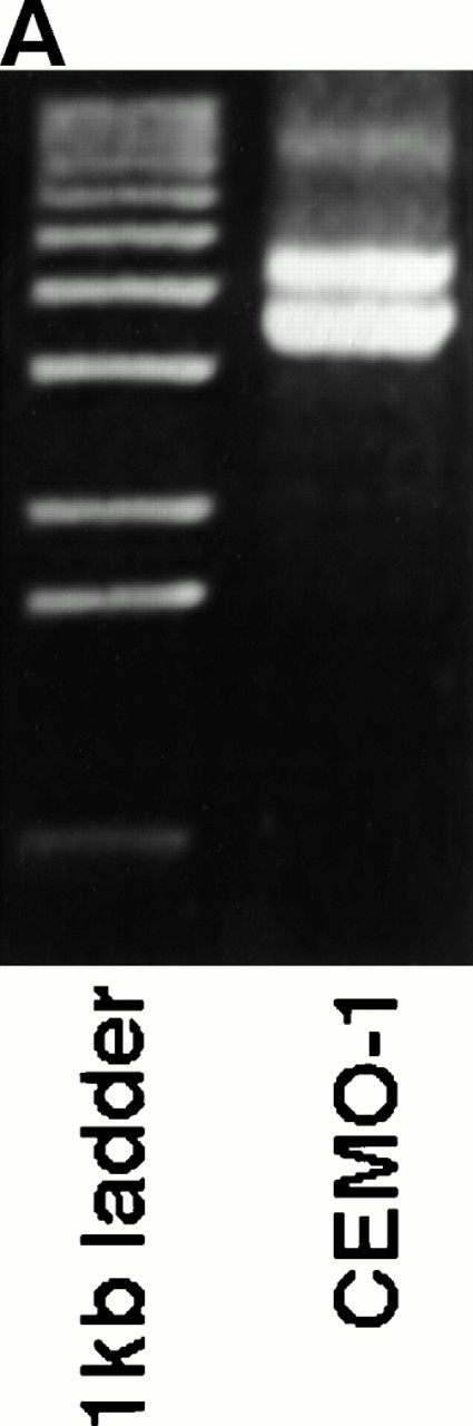 Fig. 1. (A) LDI-PCR products from HindIII-digested CEMO-1 DNA. Bands of 3.7 and 4.3 kb were amplified, corresponding to the rearrangements seen on Southern blot. Five microliters of PCR product was analyzed on 0.8% agarose stained with ethidium bromide. (B) DNA sequence analysis of translocation breakpoint from 4.3-kb LDI-PCR product (clone CH4.3). DNA sequence is compared with germline IGHJsequence and BCL9 cDNA sequence. Shaded region denotesJH5 sequence. (C) Restriction map of LDI-PCR clone CH4.3. The breakpoint in CEMO-1 is indicated by an arrow. Probe X665 is indicated by heavy horizontal bar. This probe was used to screen PAC library and for Northern and Southern analysis. Bg, Bgl II;H, HindIII; P, Pst I; X,Xho I.
