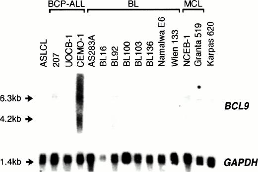 Fig. 5. Northern blot analysis of 10 μg total RNA from various cell lines of B-cell lineage. ASLCL, an EBV-transformed normal B-lymphoblastoid cell line acted as negative control. Both a truncated 6.3-kb and the 4.2-kb BCL9 transcript were overexpressed in the CEMO-1 cell line but not in any other B-cell lines with 1q21 abnormalities (Table 1).
