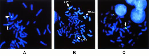 Fig. 2. FISH results for BCL9 probes. (A) Localization of PAC containing BCL9 sequences to chromosome 1q21 on normal metaphases. (B) Rearrangement of CEPH YAC 882B3 in case no. 2 with t(1;22)(q21;q11), showing hybridization signals at the breakpoints of both der(1) and der(22) chromosomes. (C) Metaphase of case no. 7 showing YAC 882B3 hybridization signals on normal 1 and der(19) chromosomes. Amplification of hybridization signal on the add(1) is shown by a solid arrow. Note the extra unidentified material between centromere and YAC signal.