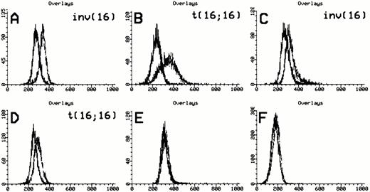Fig. 2. Anti-inv16 antibody detection of CBFβ-SMMHC fusions. Flow cytometric detection of CBFβ-SMMHC using anti-inv16 Ab. The black trace represents isotype control. The gray trace represents anti-inv(16) Ab. (A and B) PN 13 and PN 21, respectively, demonstrating detection of type A fusion product; (C) PN 1 with type D fusion detected by anti-inv16 Ab; (D) PN 22 with novel CBFB-MYH11fusion; (E and F) PN 28 and PN 30 negative controls. Refer to Table 1and text for details.
