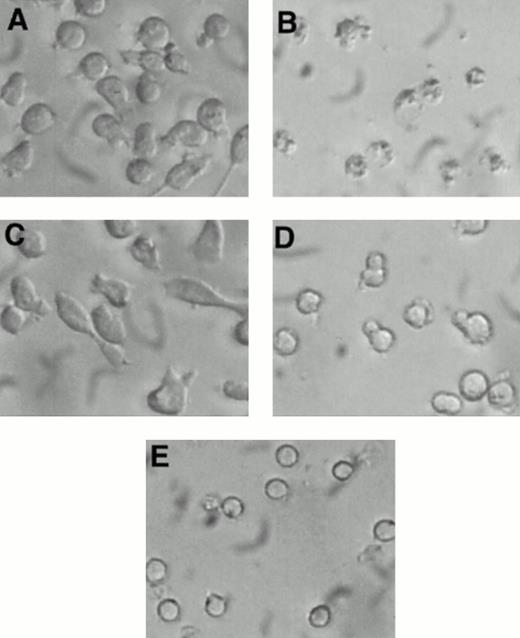 Fig. 4. Morphology of 32D-Kit cells incubated with factor and Ca2+ influx blockers. 32D-Kit cells were incubated for 18 hours with (A) SLF alone, (B) SLF + 8 μmol/L econazole, (C) IL-3 alone, or (D) IL-3 + 8 μmol/L econazole. (E) Cells were incubated with no added factor.