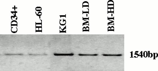 Fig. 1. Detection of Smad5 mRNA in the immortalized myeloid leukemia cell lines KG1 and HL-60, as well as low density mononuclear, high density polymorphonuclear and CD34+ selected cells isolated from normal human BM. The entire coding region of Smad5 was amplified by PCR from RNA isolated from the various sources and analyzed on an agarose gel. In all cell populations analyzed, a single band representing the full length coding region was found.