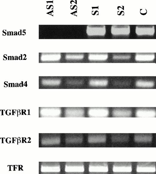 Fig. 2. Analysis of Smad5 mRNA levels in antisense-treated CD34+ cells. RNA from approximately 10,000 CD34+ BM cells preincubated with antisense oligonucleotides to the Smad5 gene were analyzed by RT-PCR for the presence of Smad5, Smad2, Smad4, TGF-β receptor subunit 1 (TGF-βR1), TGF-β receptor subunit 2 (TGF-βR2) and TFR (as a nonspecific control) mRNA. Amplifications were done under identical conditions and RNA concentrations and represent time points within the exponential phase of the assay. Samples treated with antisense oligonucleotides to Smad5 (AS1 and AS2) contain barely detectable or undetectable levels of Smad5 mRNA, whereas samples treated with sense oligonucleotides (S1 and S2) or mock-treated samples (control) contain similar amounts of Smad5 message. The levels of all other mRNA species were unaffected for all treatments.