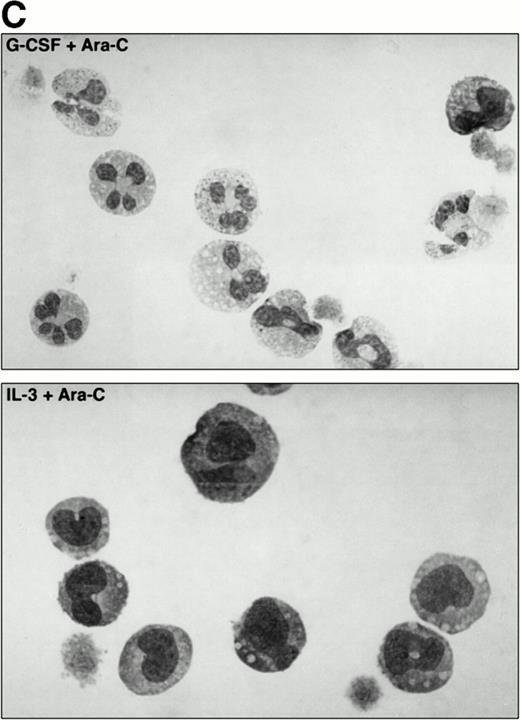 Fig. 6. The effect of Ara-C on proliferation and differentiation of 32D/WT cells. (A) G-CSF– and IL-3–dependent proliferation of 32D/WT cells in the absence or presence of Ara-C. The numbers of viable cells were determined on the basis of trypan blue exclusion at the indicated times. (□) G-CSF; (▪) G-CSF + Ara-C; (▵) IL-3; (▾) IL-3 + Ara-C. (B) Cell cycle distribution of 32D/WT cells cultured for 3 days in G-CSF– or IL-3–containing medium in the absence or presence of Ara-C. The percentages of cells in the G1, S, and G2/M phases of the cell cycle are given in the upper right of the panels. (C) Morphology of 32D/WT cells cultured for 3 days in G-CSF– or IL-3–containing medium in the presence of Ara-C (May-Grünwald-Giemsa staining; original magnification × 630). (D) The percentages of terminally differentiated 32D/WT cells cultured in G-CSF– or IL-3–containing medium in the absence or presence of Ara-C. At least 200 cells were scored at the indicated times. Symbols are the same as in (A).